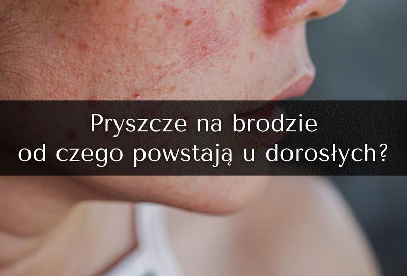 Pielęgnacja cery bez niedoskonałości