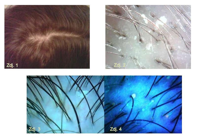 Dieta a zdrowie skóry głowy