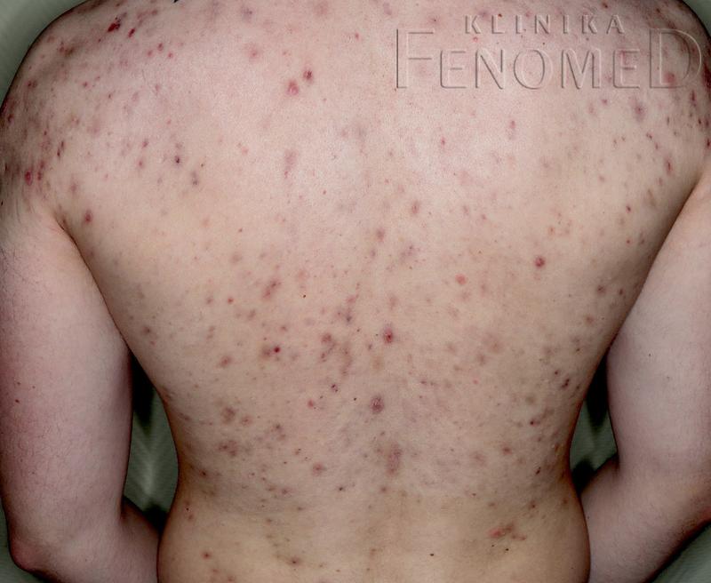 Konsultacja dermatologiczna