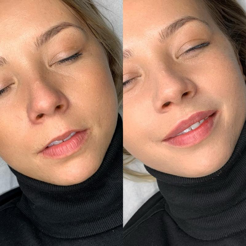 Reakcje organizmu po zabiegu