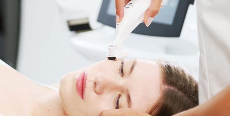 Zalety icoone laser