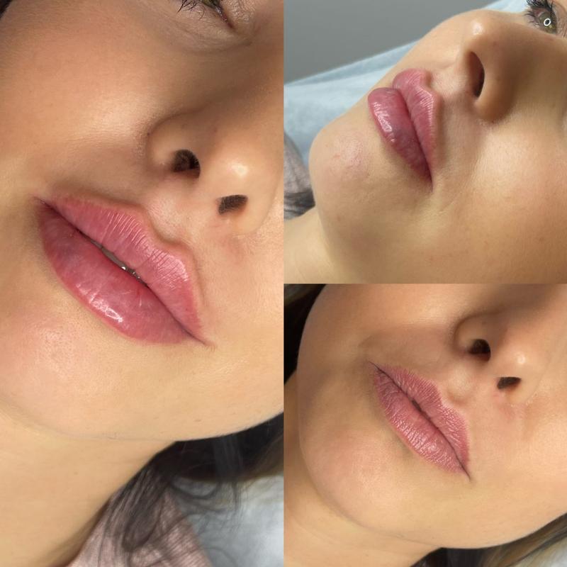 Zasady działania laserów