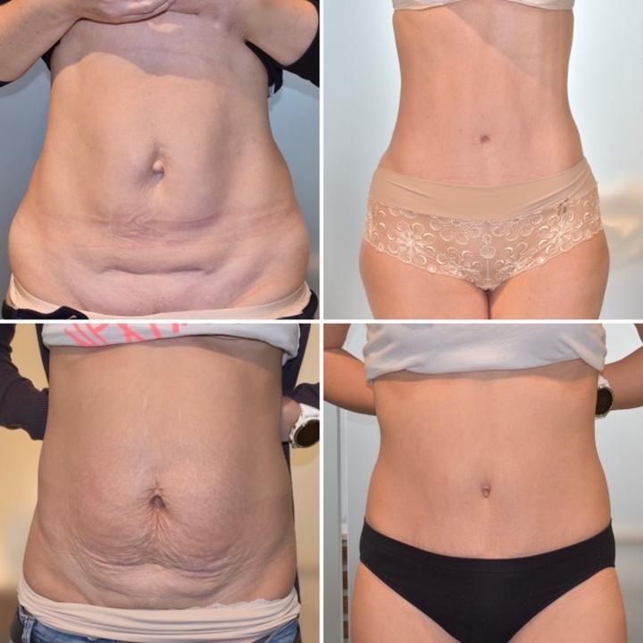 Psychiczne aspekty operacji plastycznej