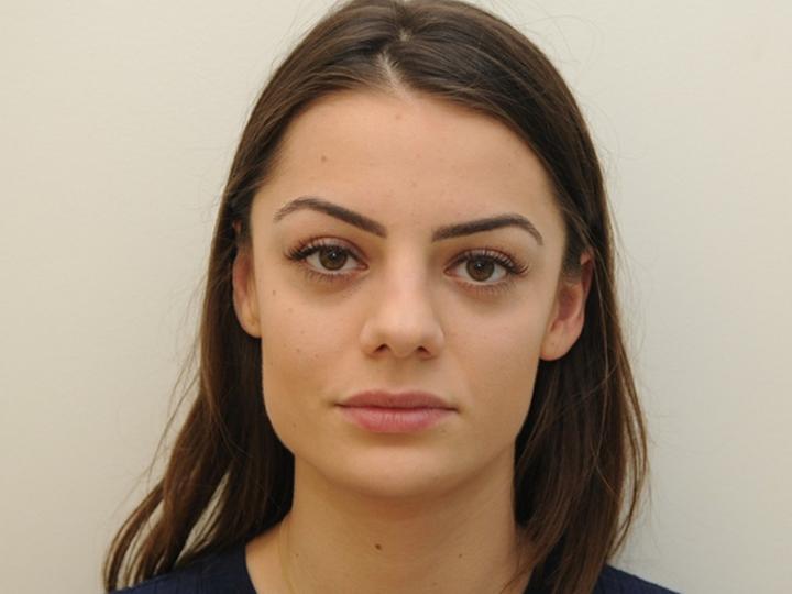 Dieta i ćwiczenia na twarz