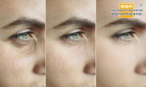 Odkryj tajniki fotoodmładzania: Jak przywrócić skórze młodzieńczy blask?