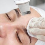 Peeling kawitacyjny w domu – czy to możliwe i jak go prawidłowo wykonać?