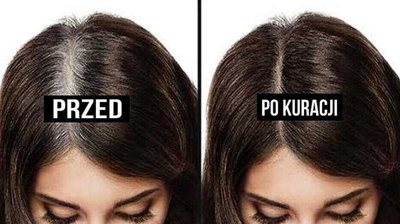 Dieta na młodzieńczy kolor włosów