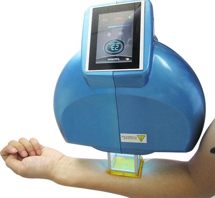 Leczenie wad wzroku laserem excimerowym