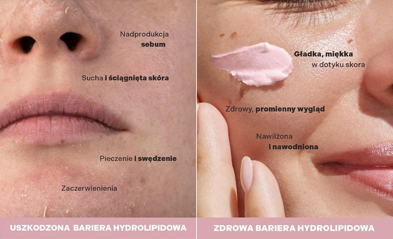 Naturalne składniki wzmacniające barierę hydrolipidową