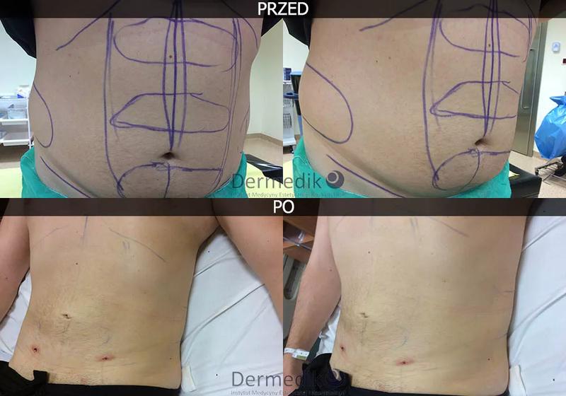 Nowoczesna medycyna estetyczna