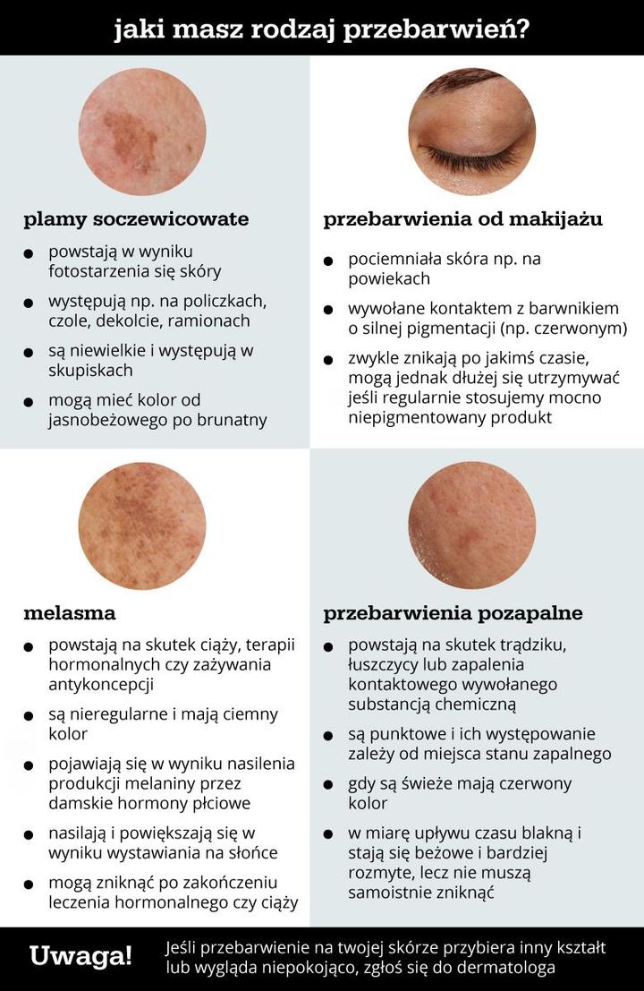 Dieta i suplementacja na przebarwienia