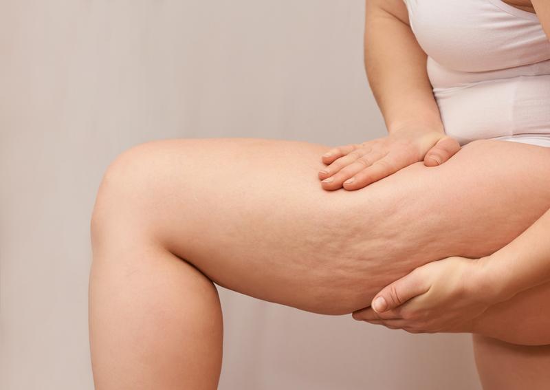 Naturalne metody na cellulit olejki i peelingi