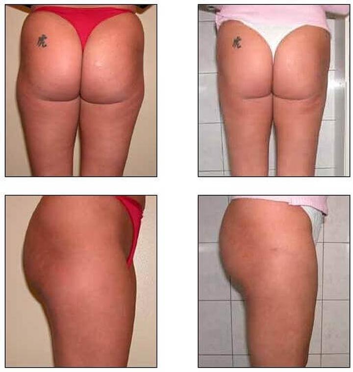 Psychologia i pewność siebie po zabiegu