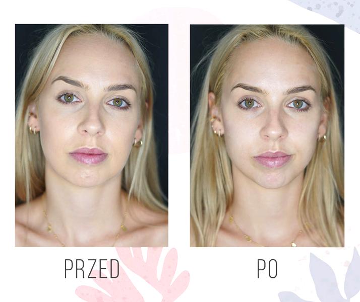 Przeciwwskazania zabiegów