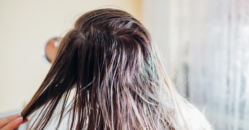 Przetłuszczające się włosy