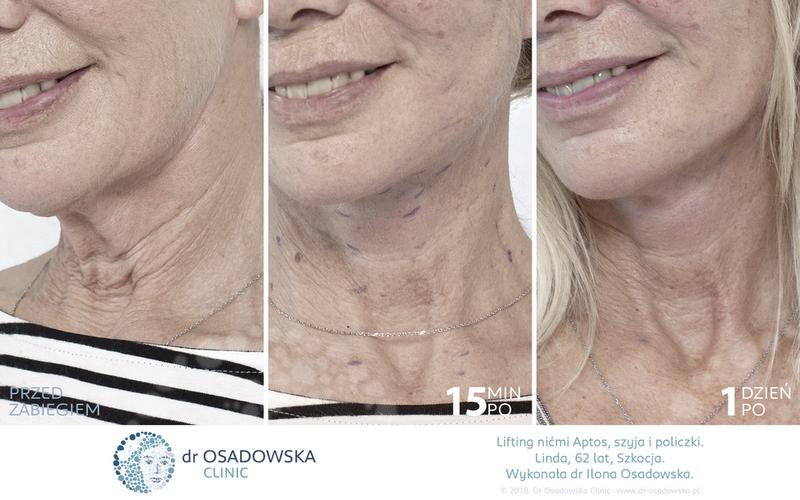 Psychologia wartości ciała