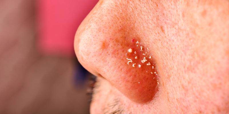 Skuteczne metody pielęgnacji