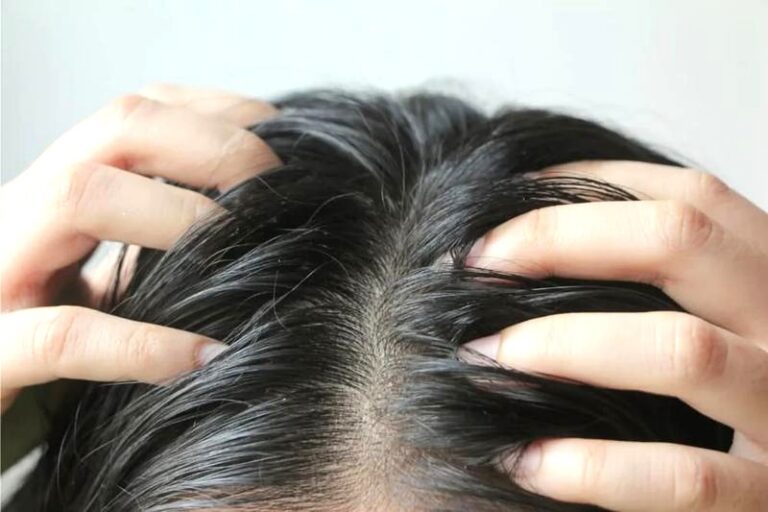Jak skutecznie radzić sobie z przetłuszczającymi się włosami?