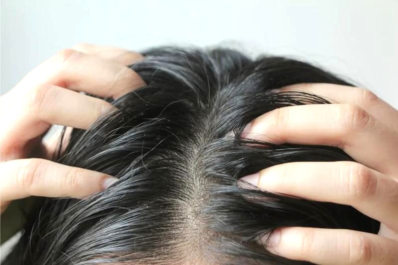 Jak skutecznie radzić sobie z przetłuszczającymi się włosami?