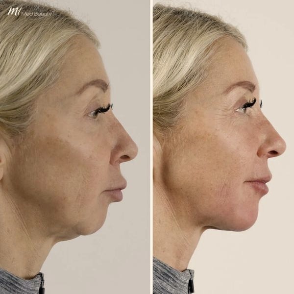 Nowe podejścia w modelowaniu zuchwy dla pięknego uśmiechu