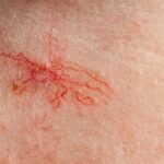 Pajaczki w naszym ogrodzie – jak je rozpoznać i chronić?