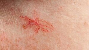 Pajaczki w naszym ogrodzie – jak je rozpoznać i chronić?