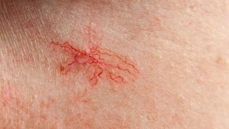 Pajaczki w naszym ogrodzie – jak je rozpoznać i chronić?