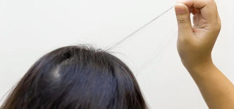 Trichotillomania