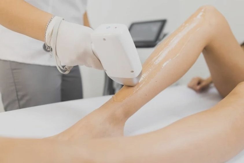 Jak skutecznie radzić sobie z nadmiernym owłosieniem?